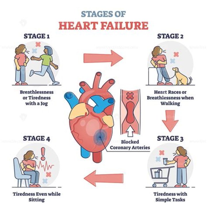 What are the final stages of heart failure?
